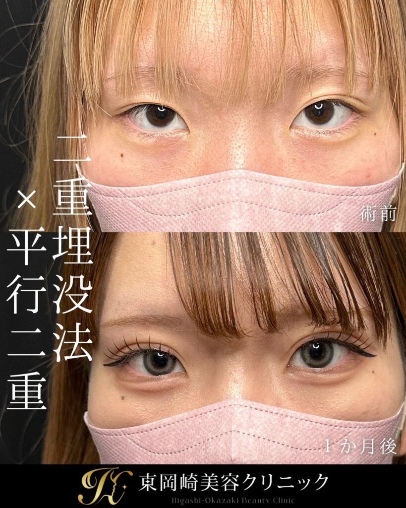 症例イメージ