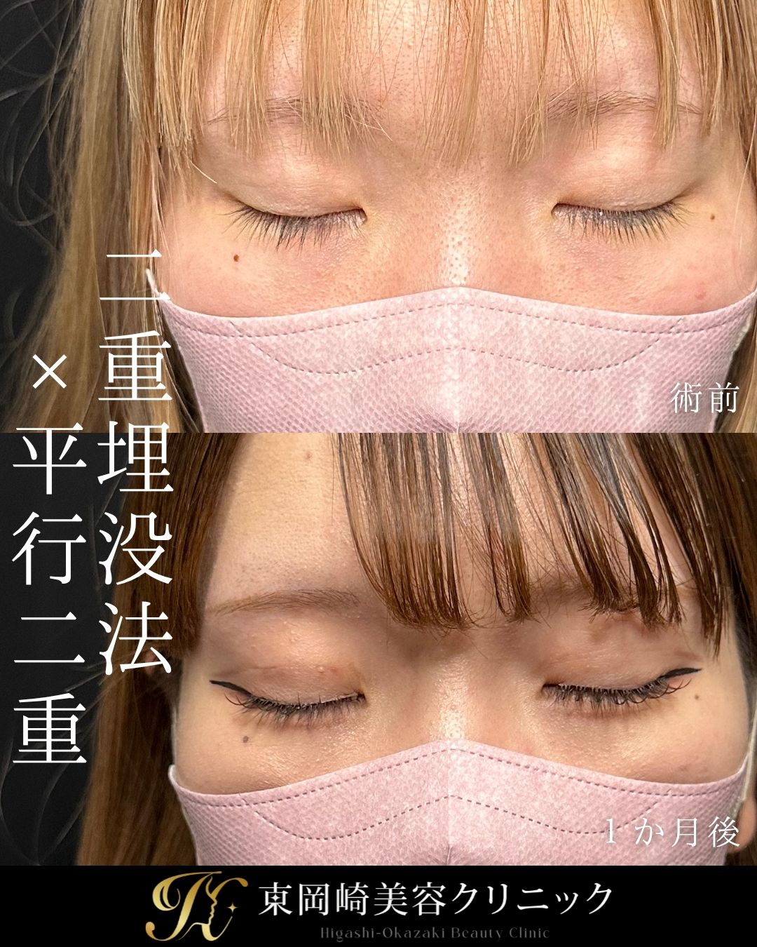 症例イメージ