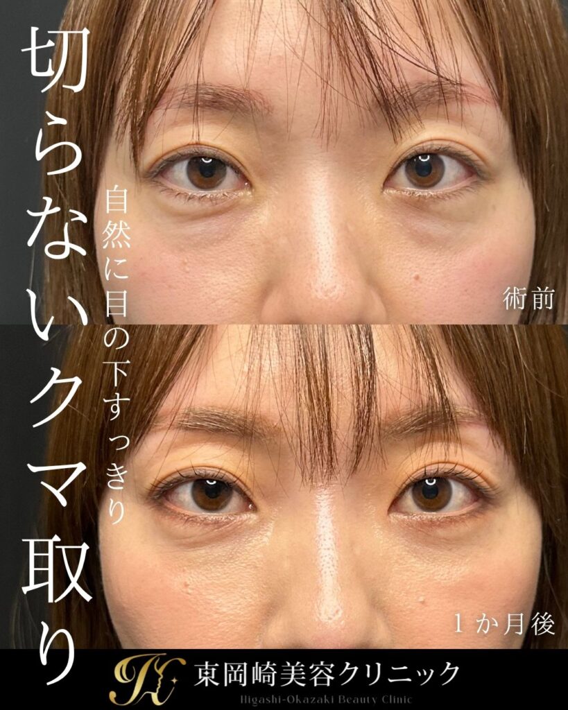 症例イメージ