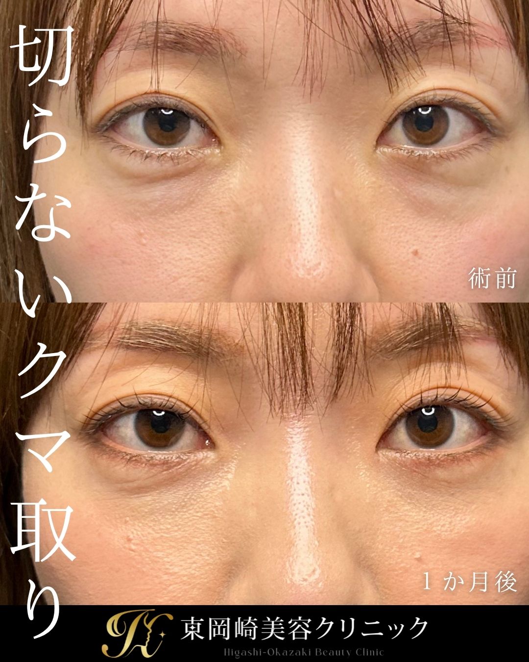症例イメージ