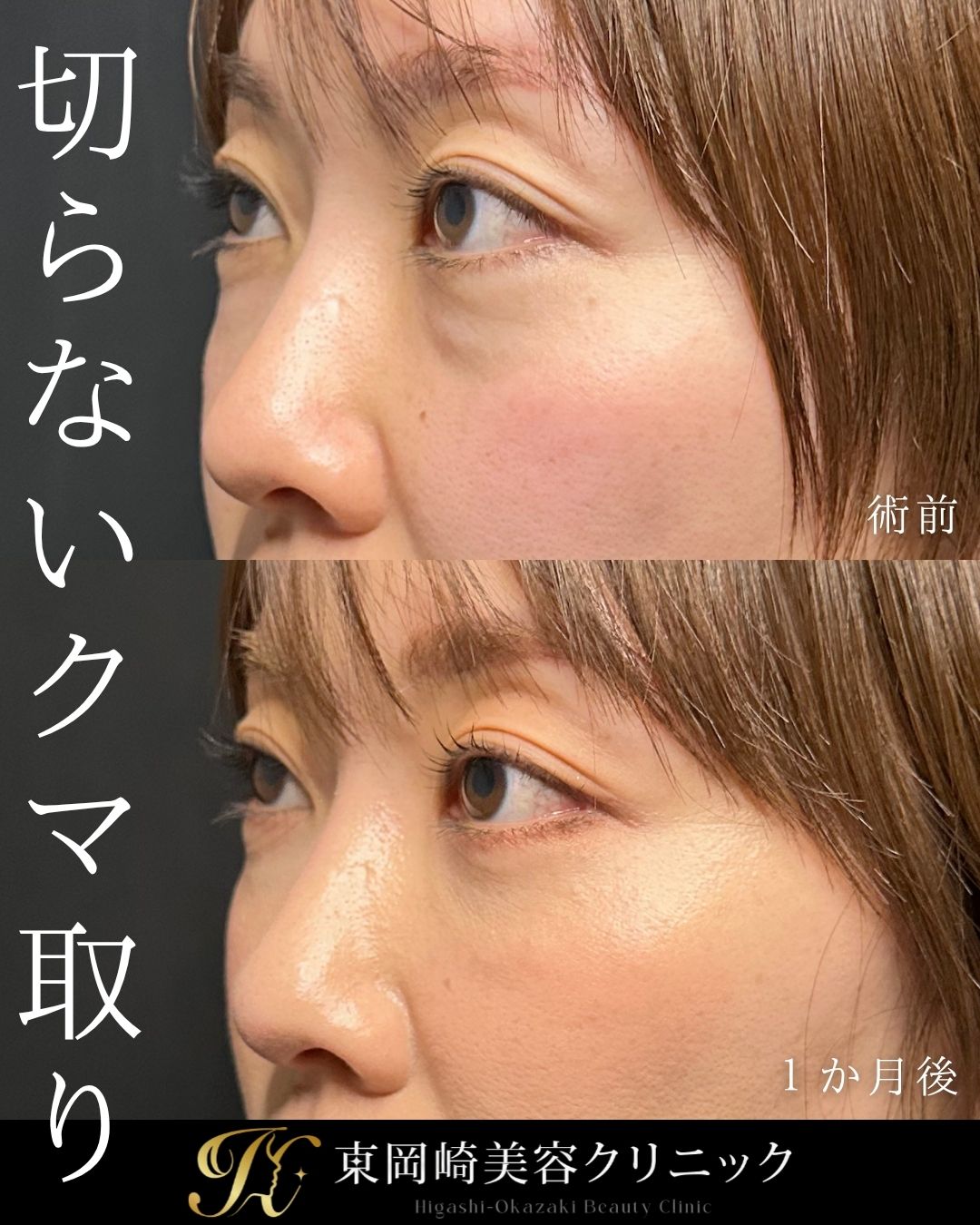 症例イメージ