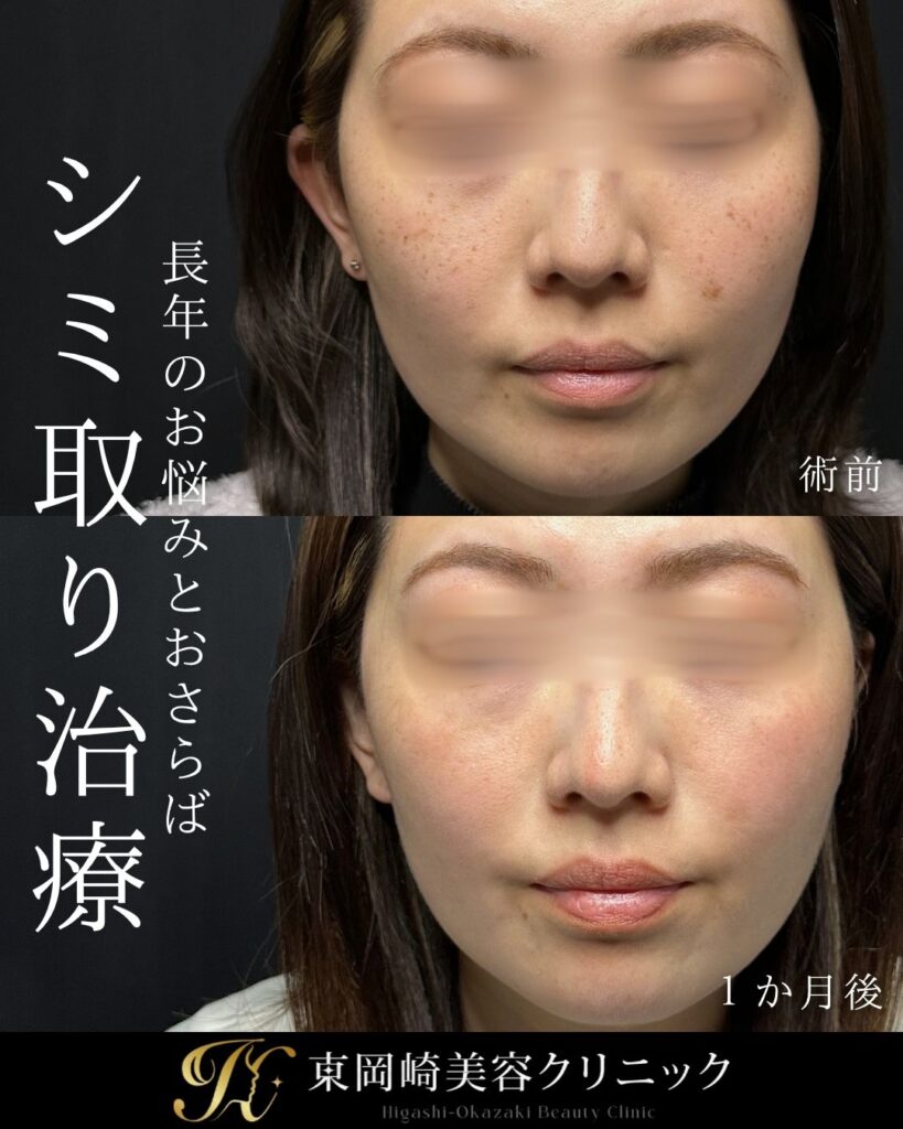 症例イメージ