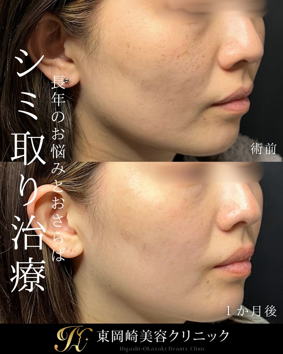 症例イメージ