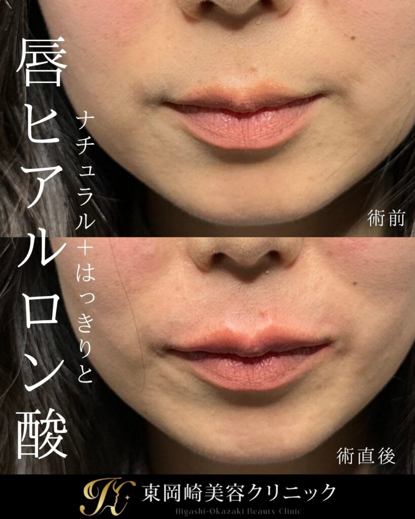 症例イメージ