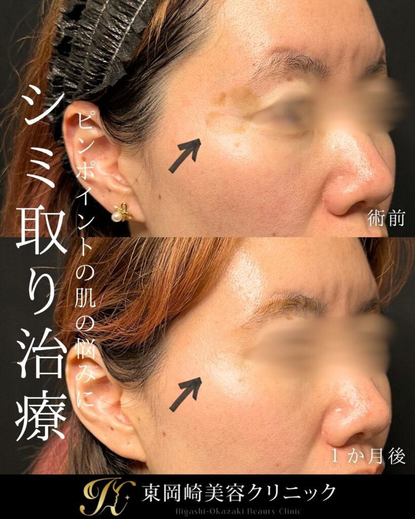 症例イメージ