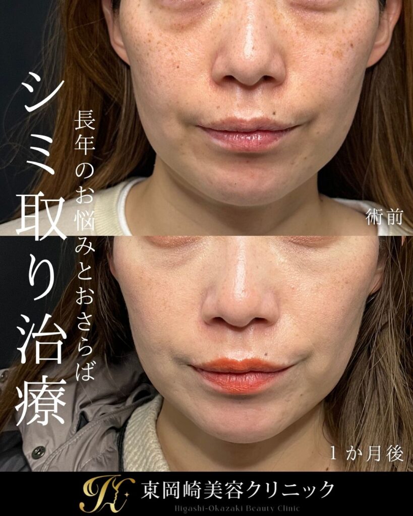 症例イメージ