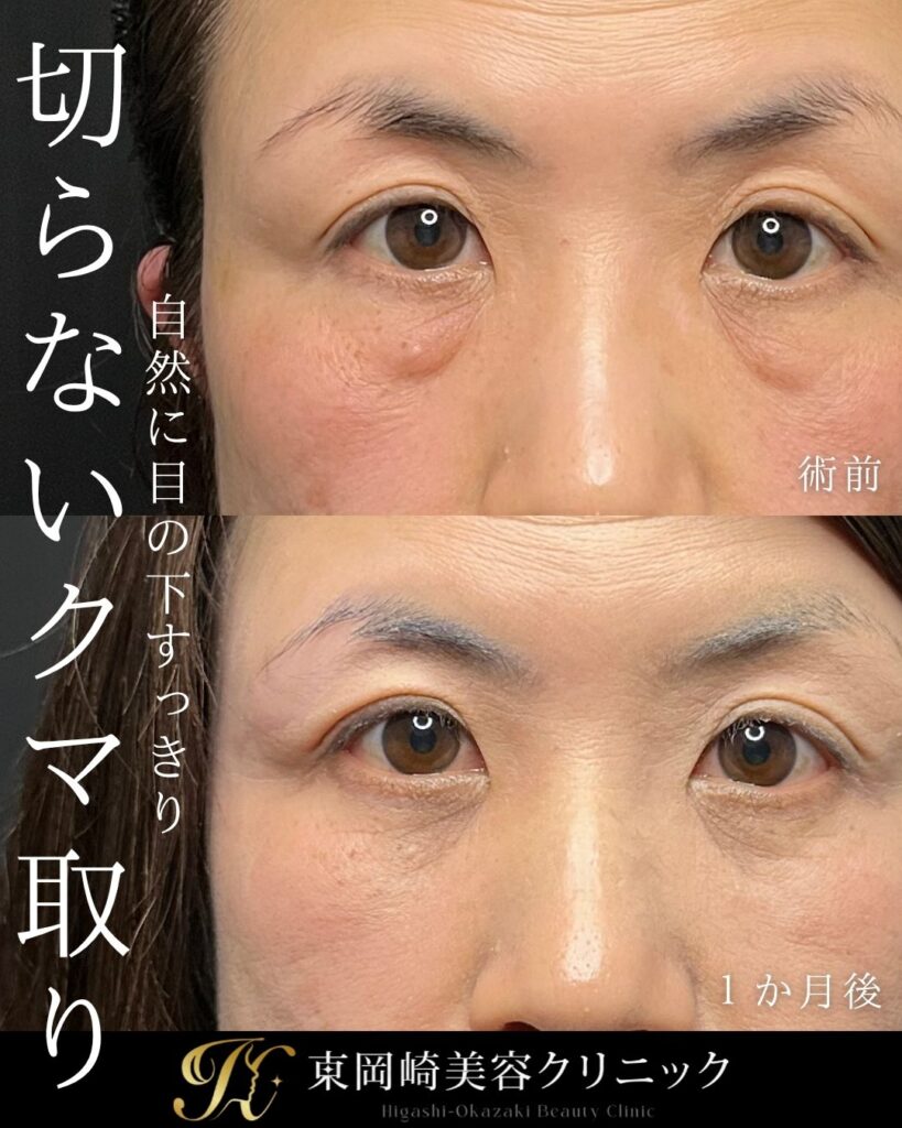 症例イメージ