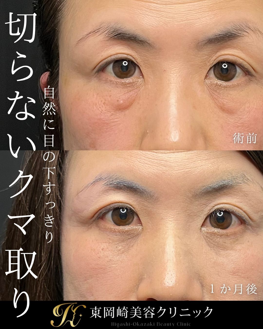 症例イメージ