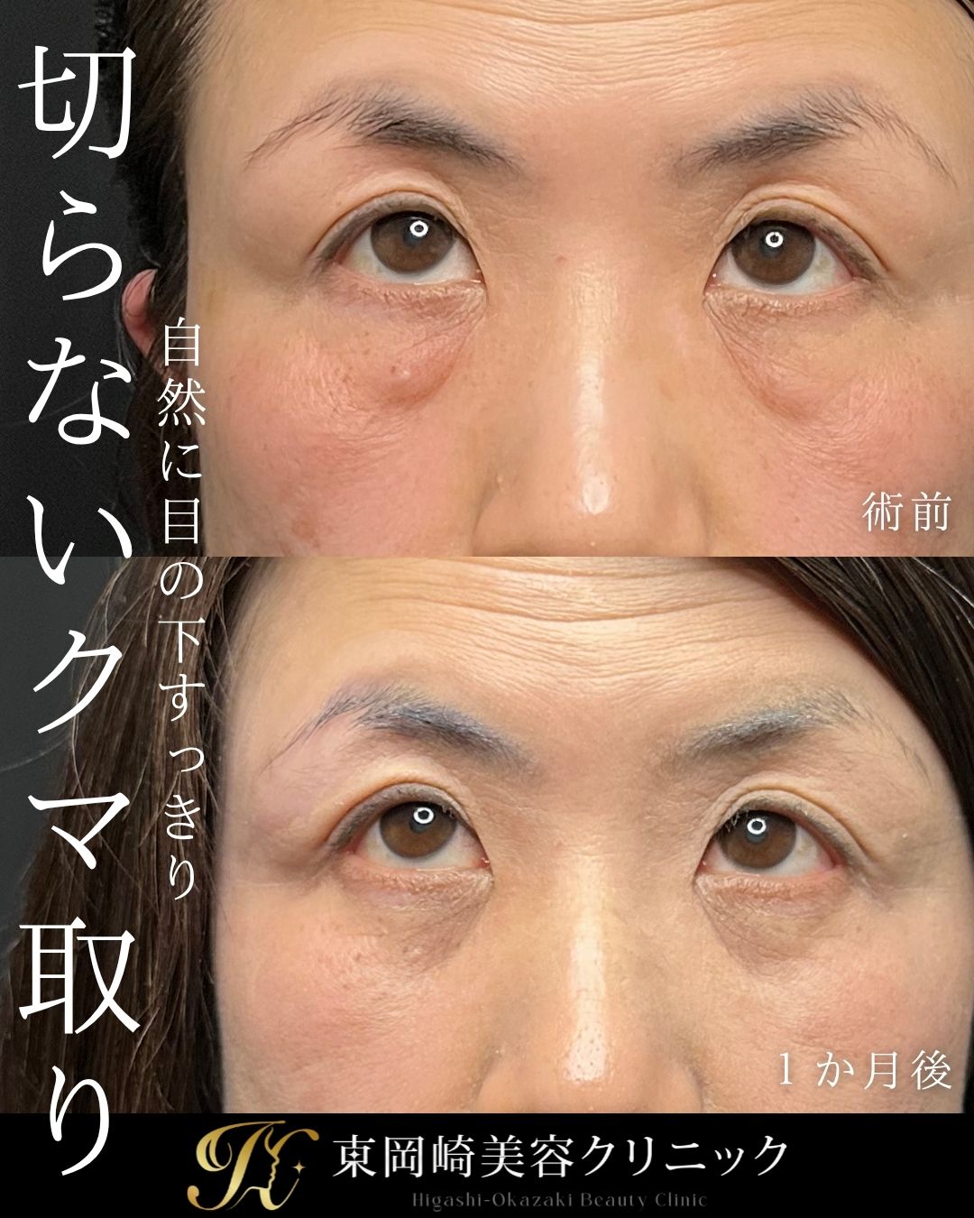 症例イメージ