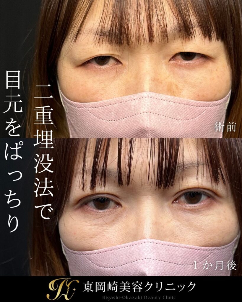 症例イメージ