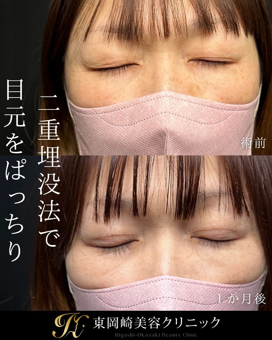 症例イメージ