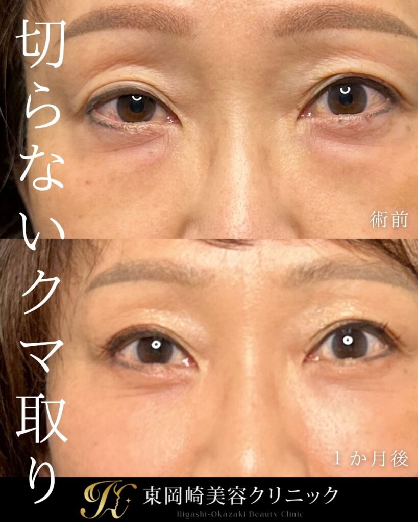 症例イメージ