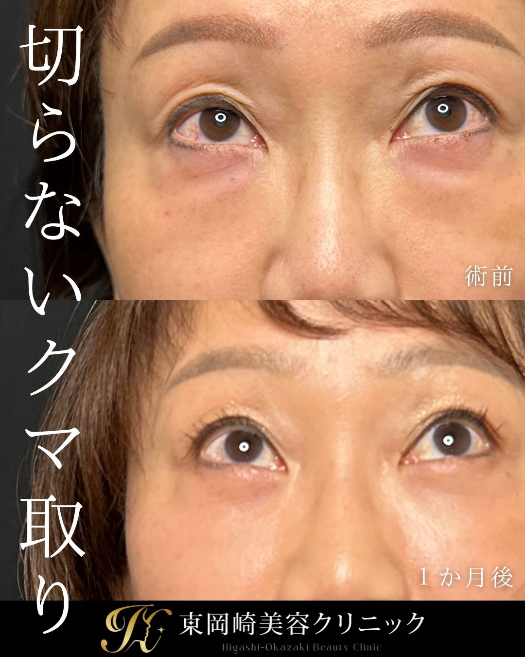 症例イメージ