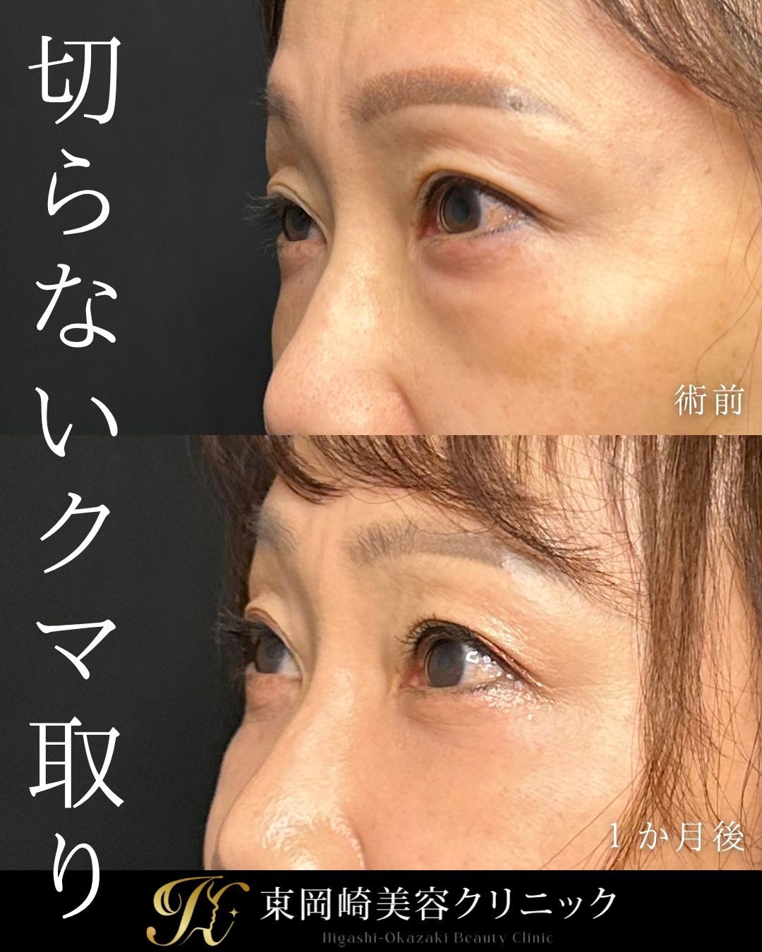 症例イメージ