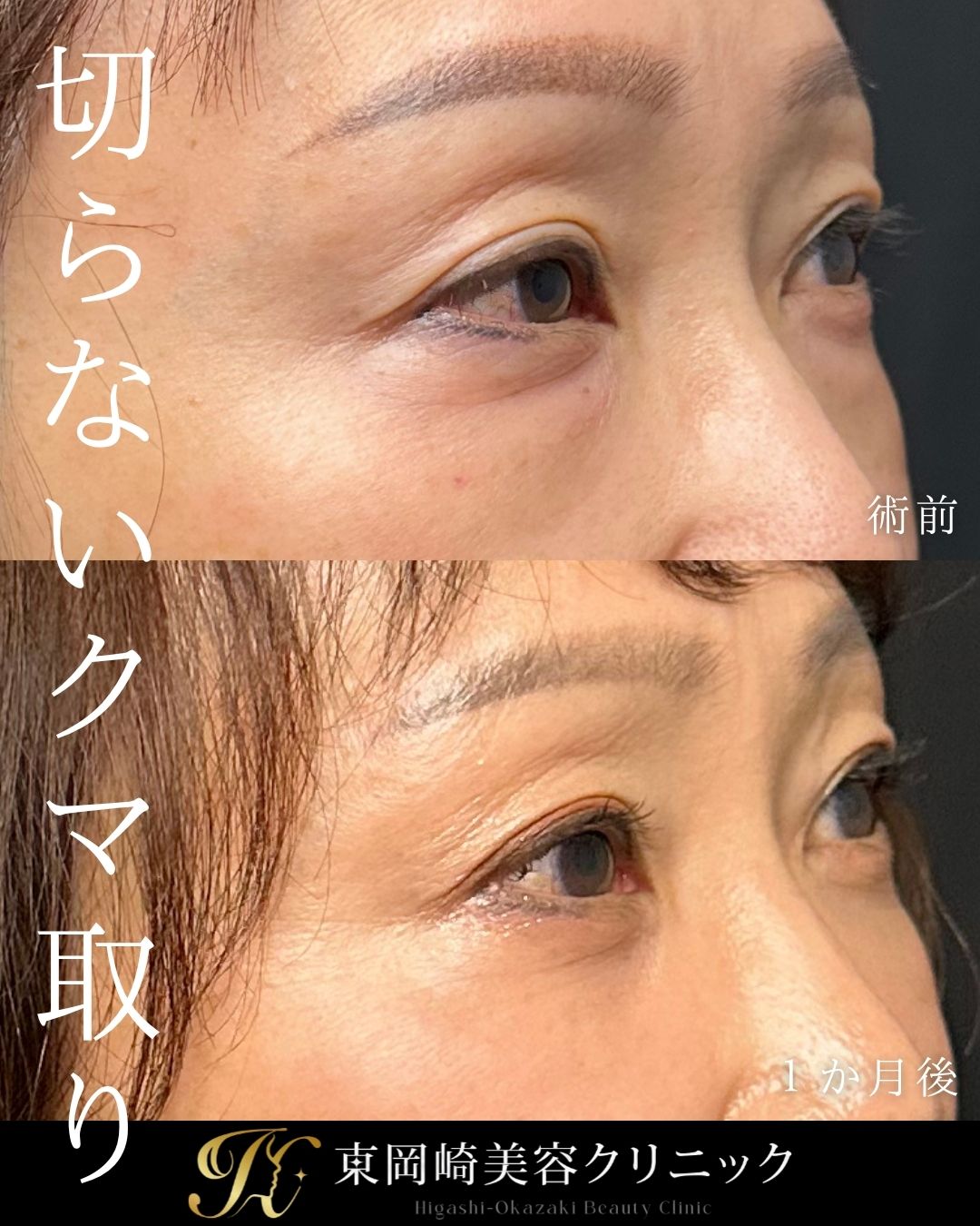 症例イメージ