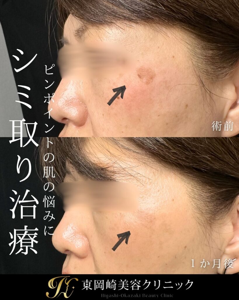 症例イメージ