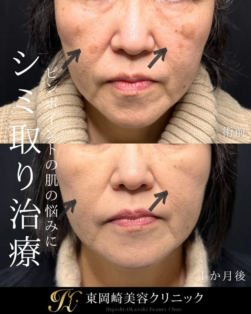 症例イメージ