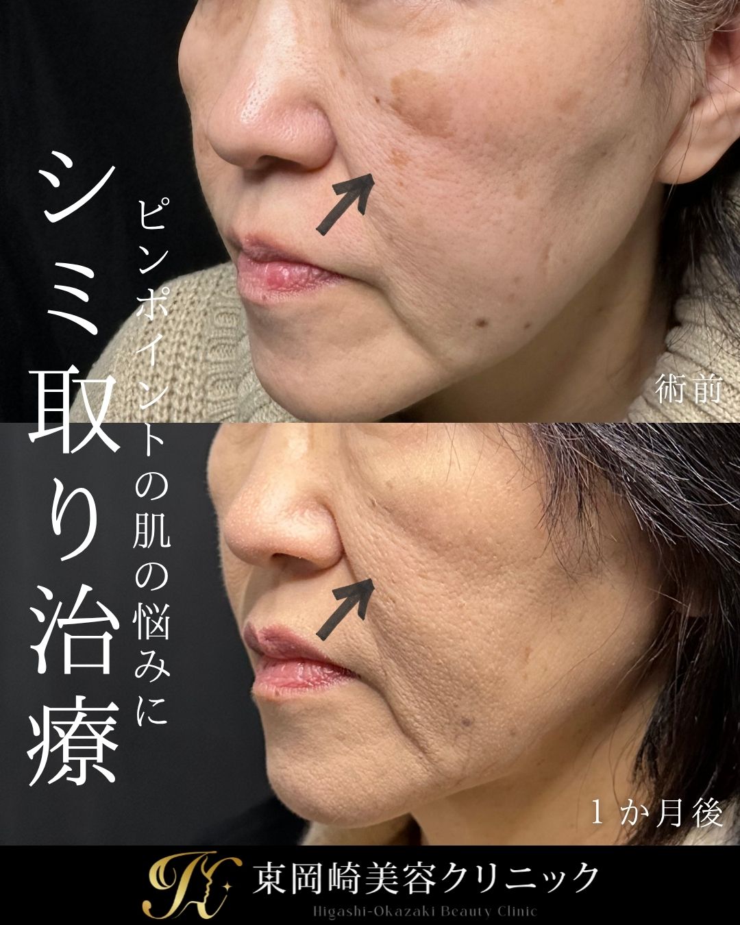 症例イメージ