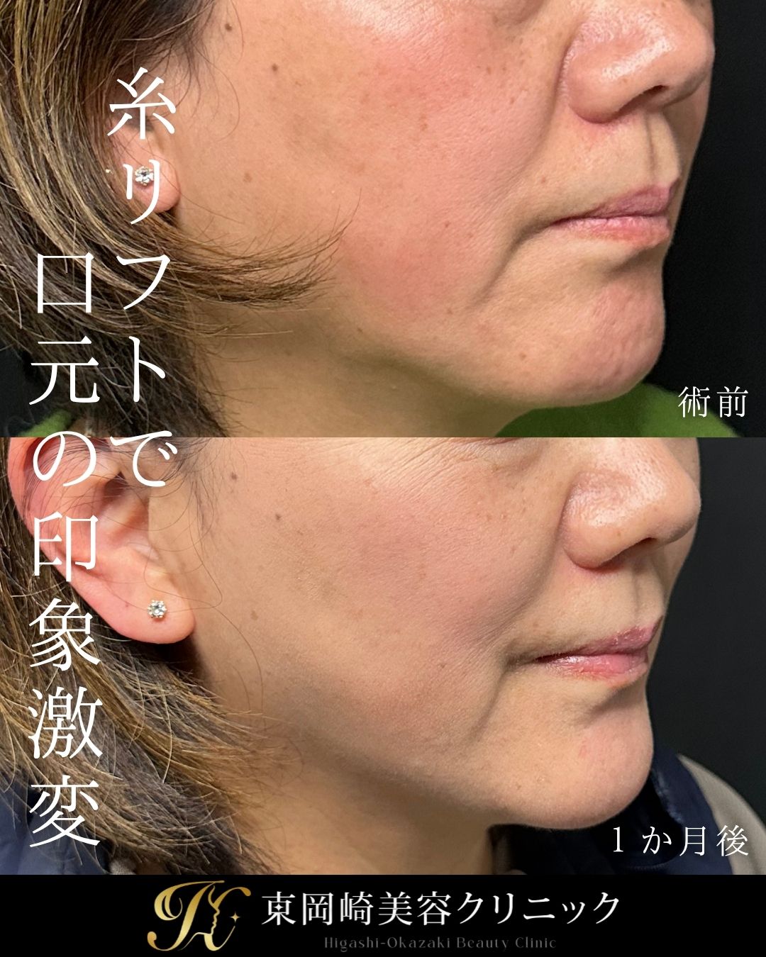 症例イメージ