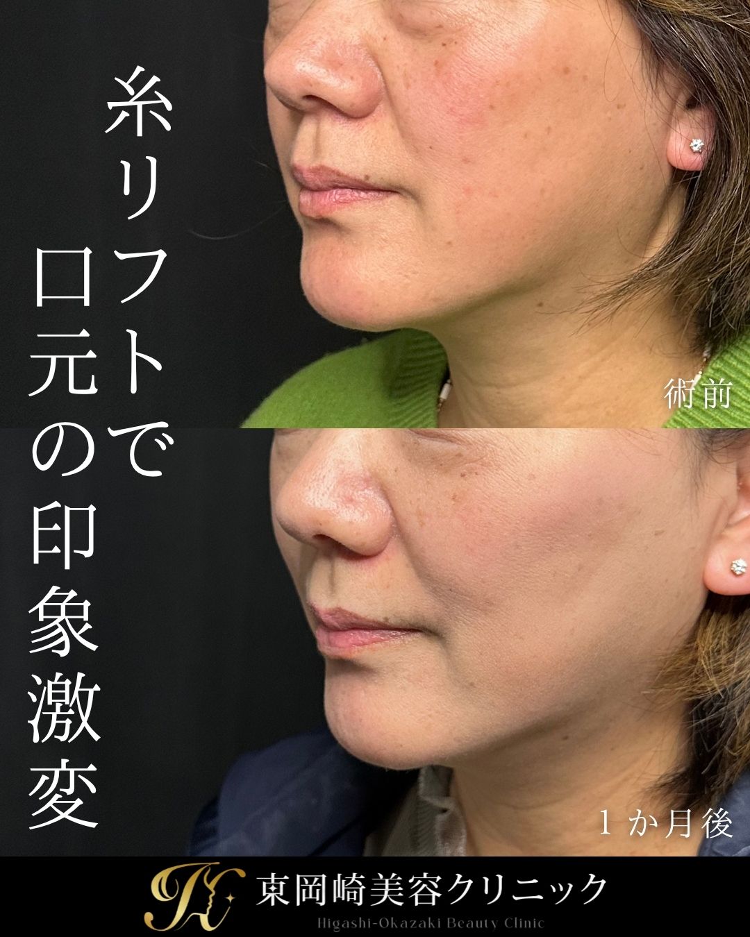 症例イメージ