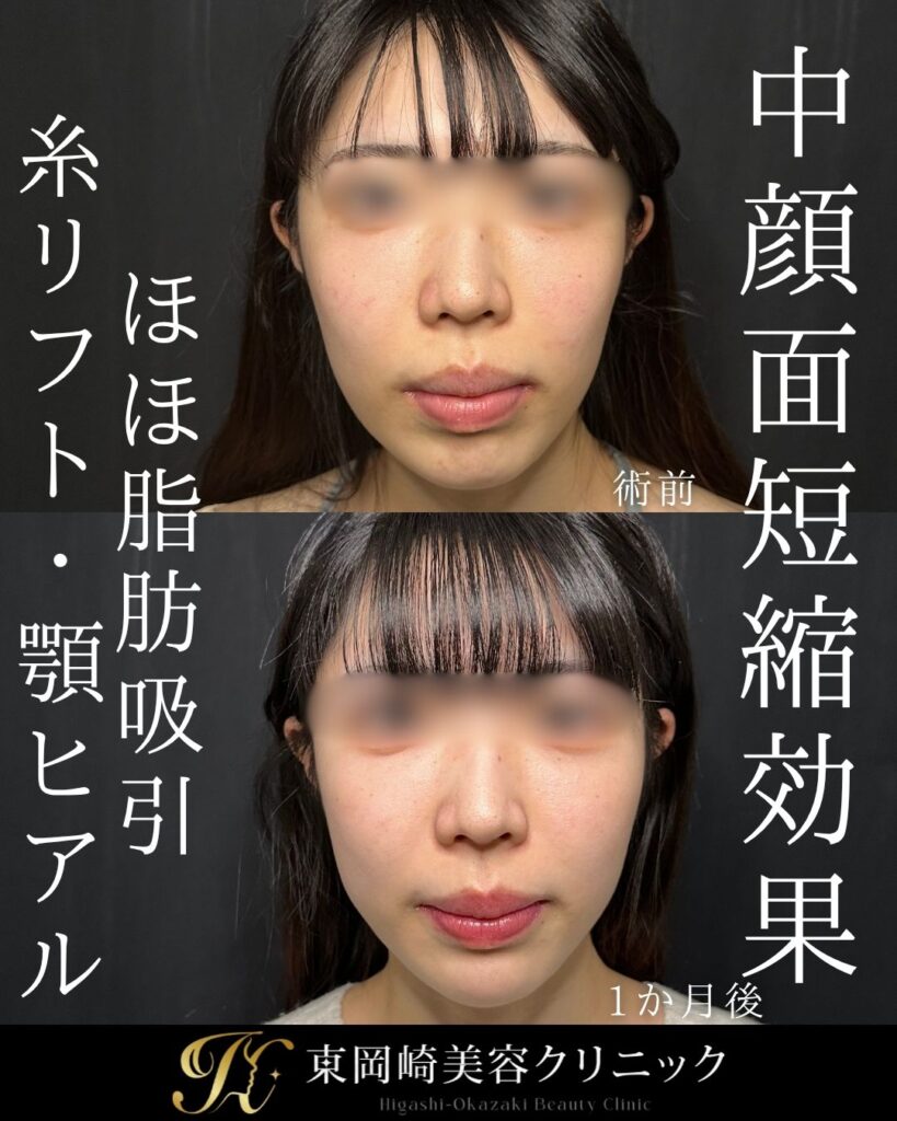 症例イメージ