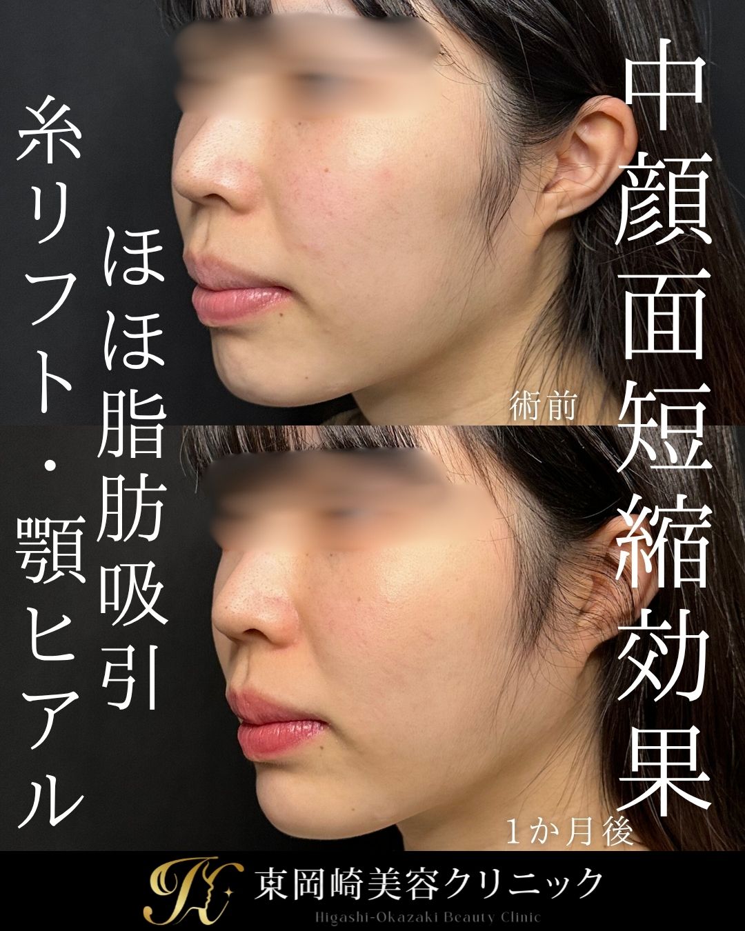 症例イメージ