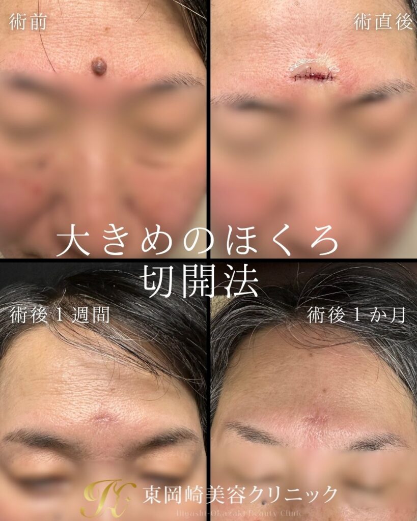 症例イメージ