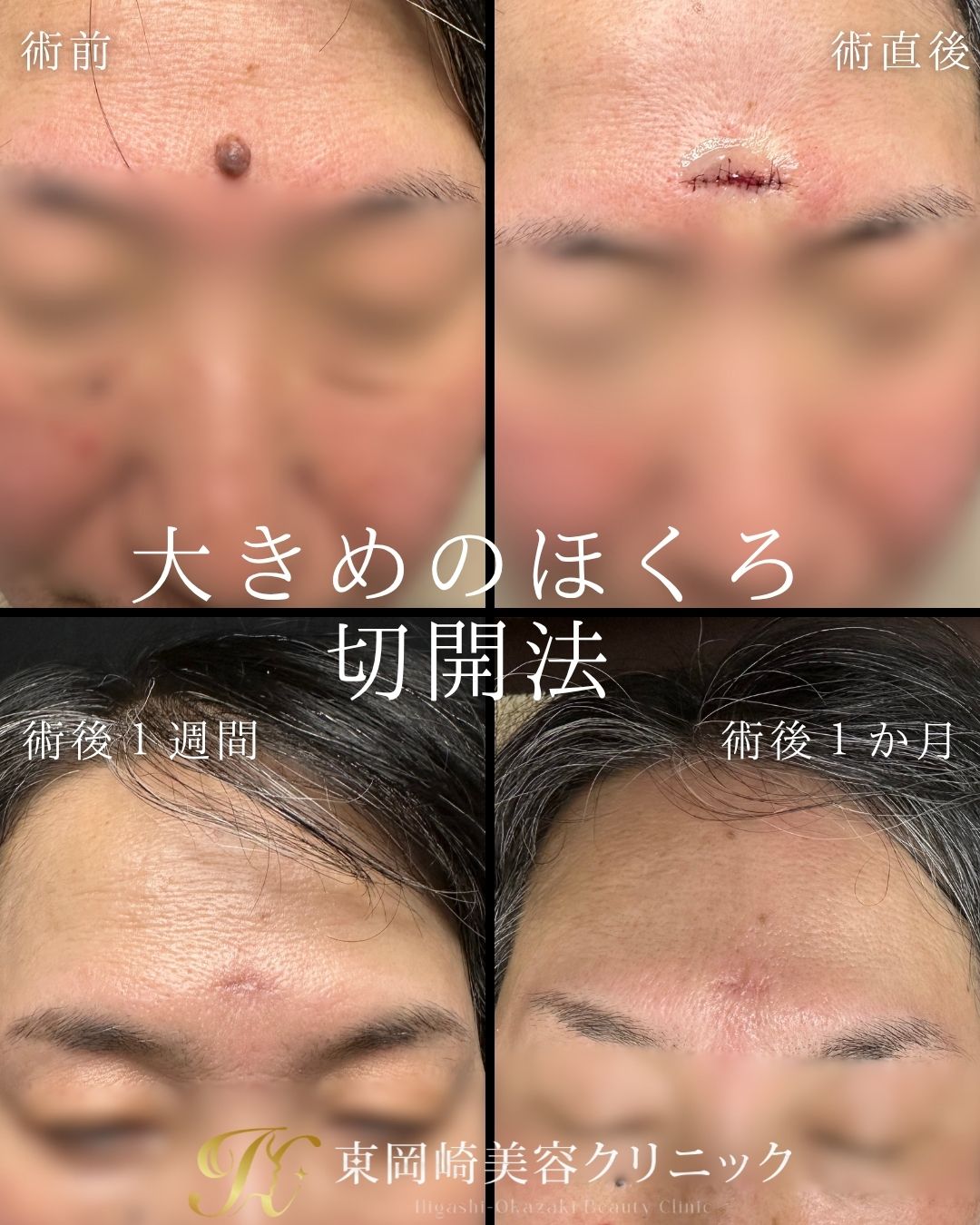 症例イメージ
