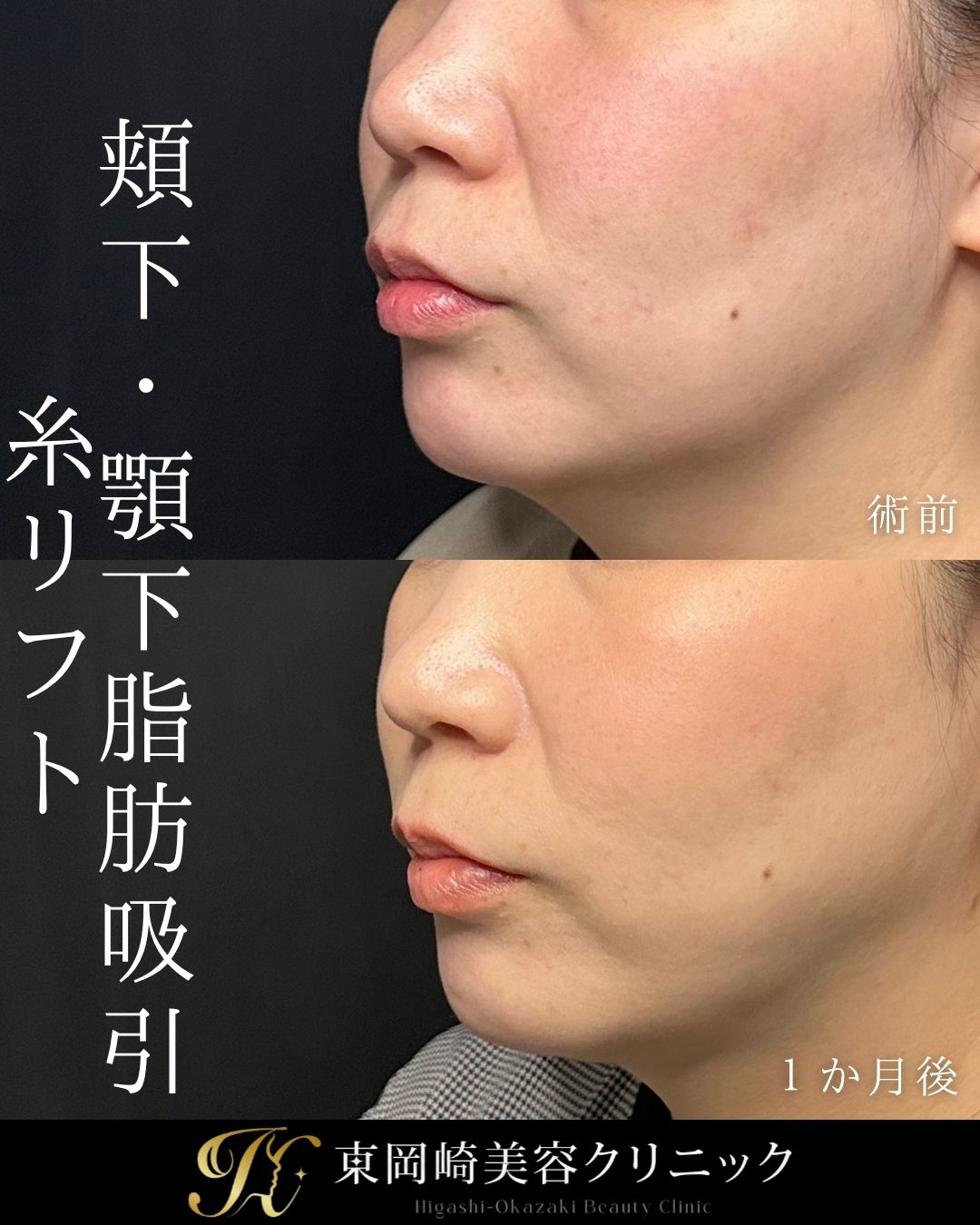症例イメージ