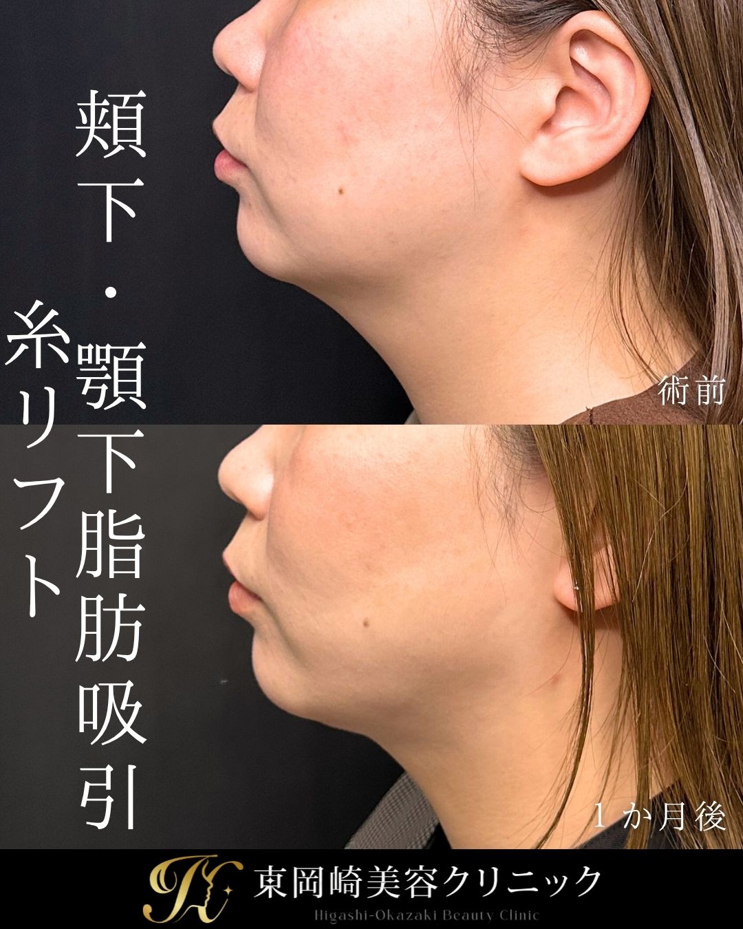 症例イメージ
