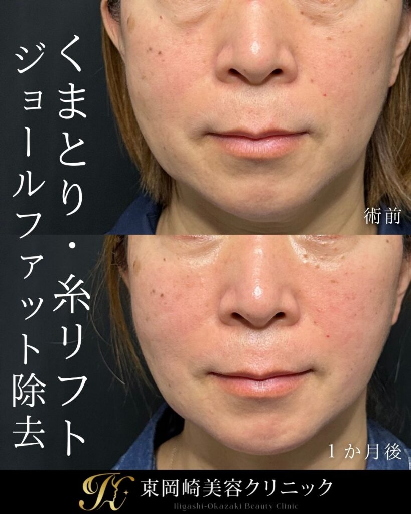 症例イメージ