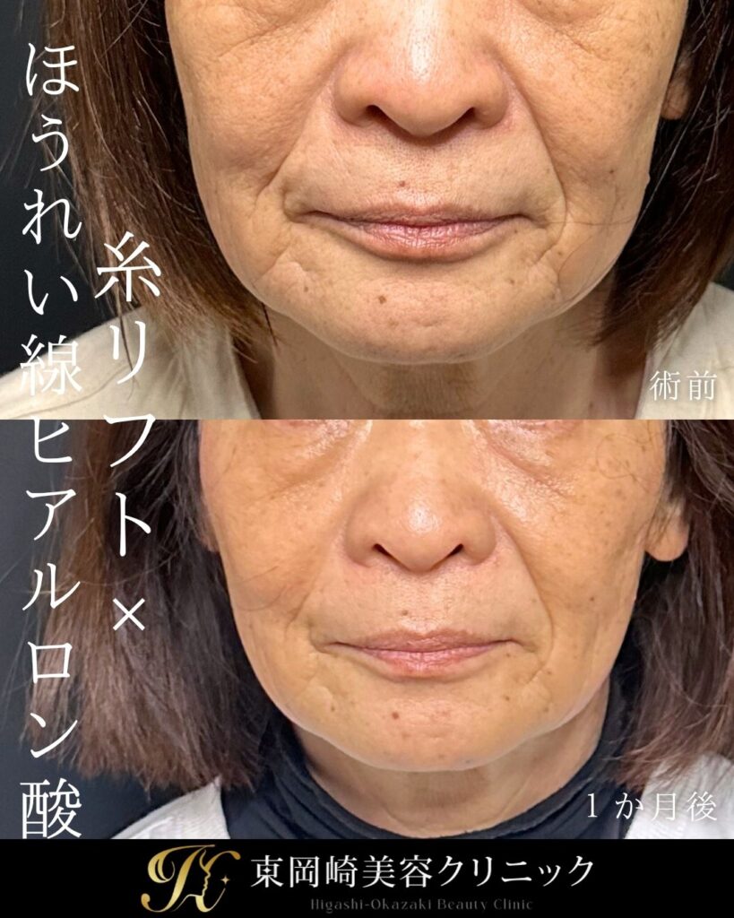 症例イメージ