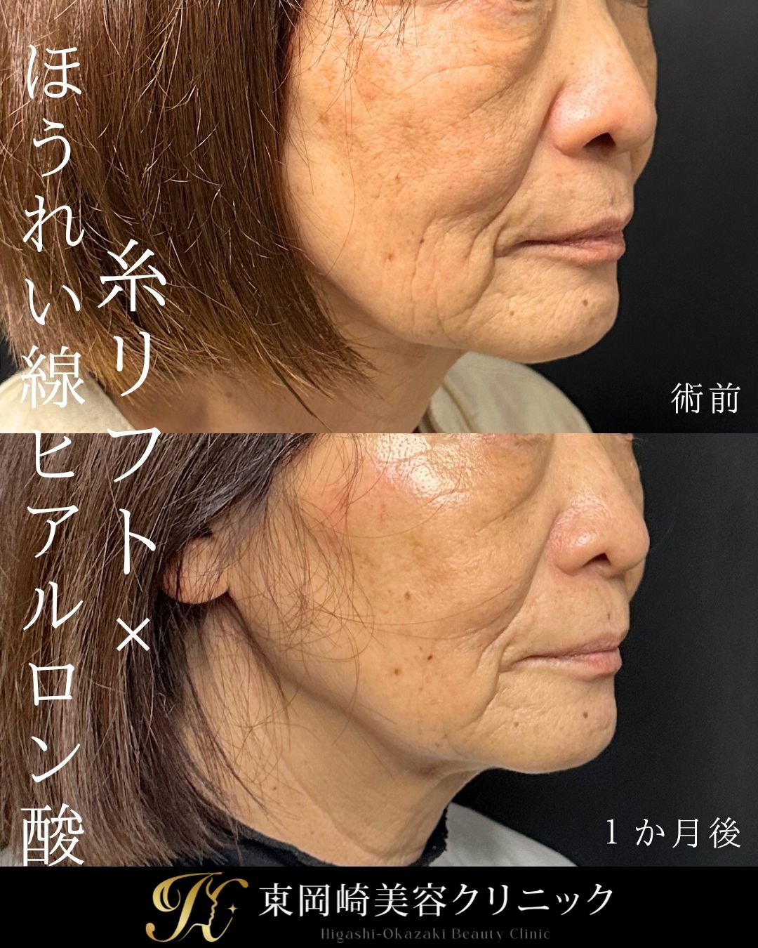 症例イメージ