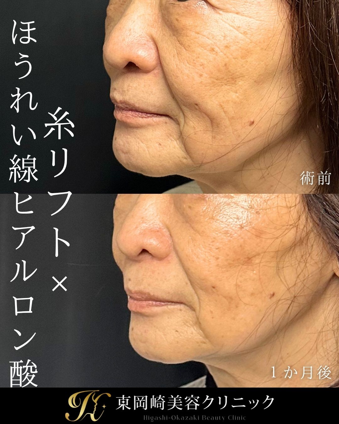 症例イメージ