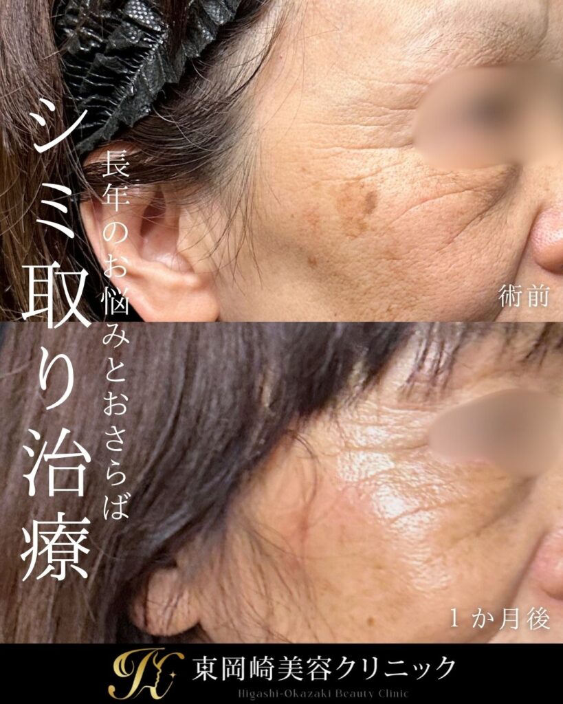 症例イメージ