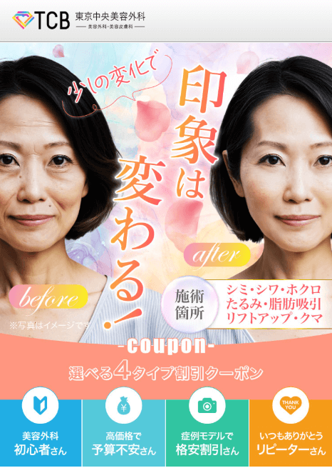 TCB東京中央美容外科-FV