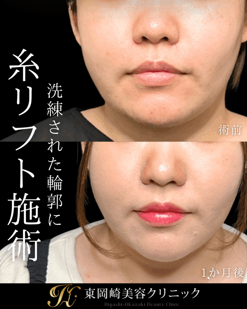 症例イメージ