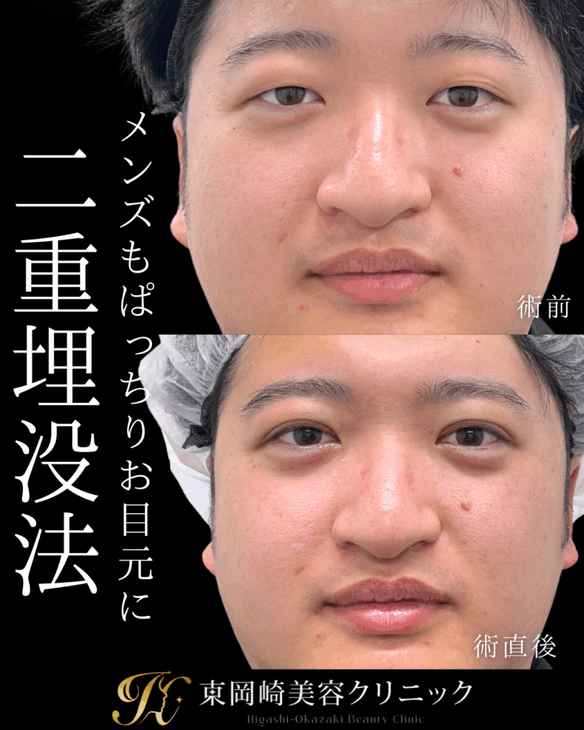症例イメージ