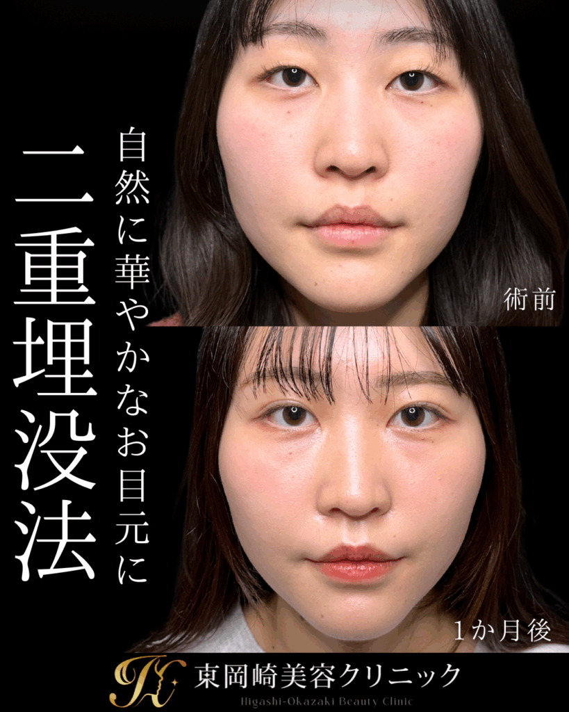 症例イメージ