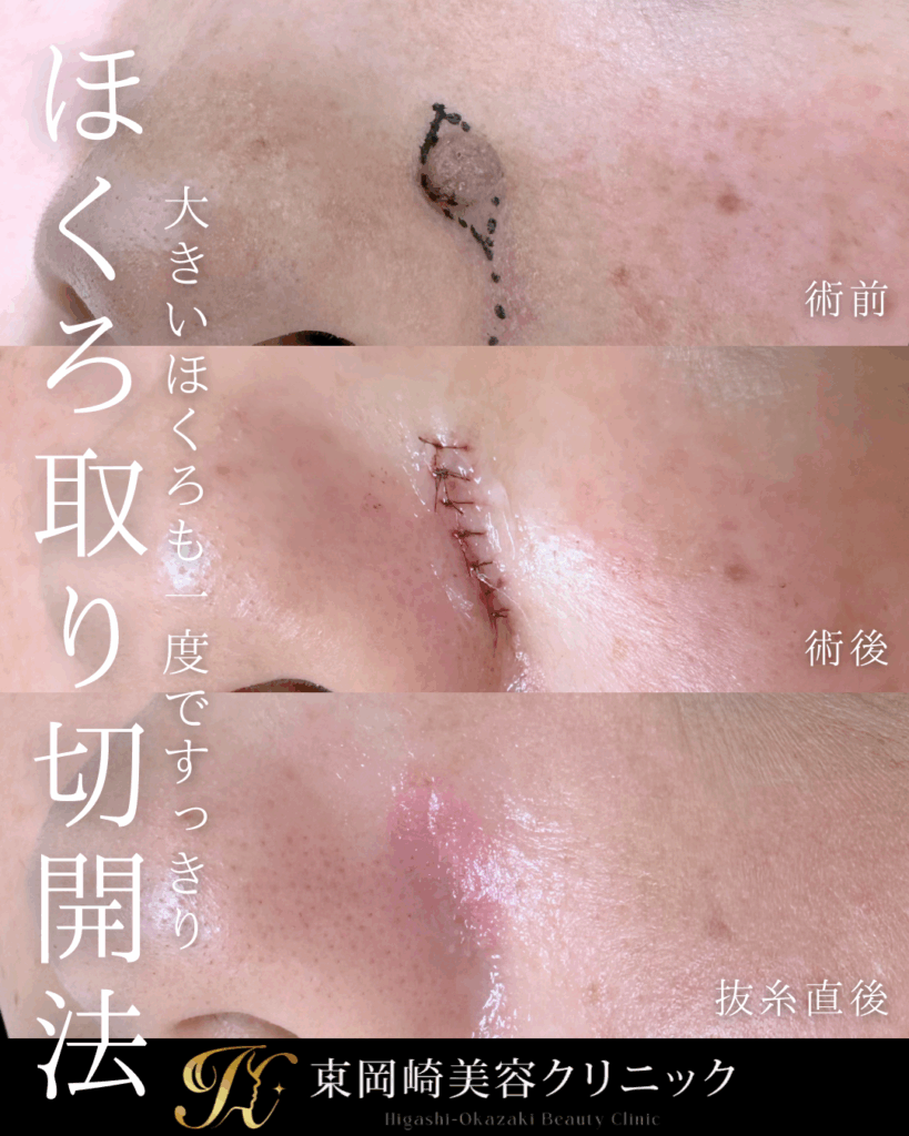 症例イメージ