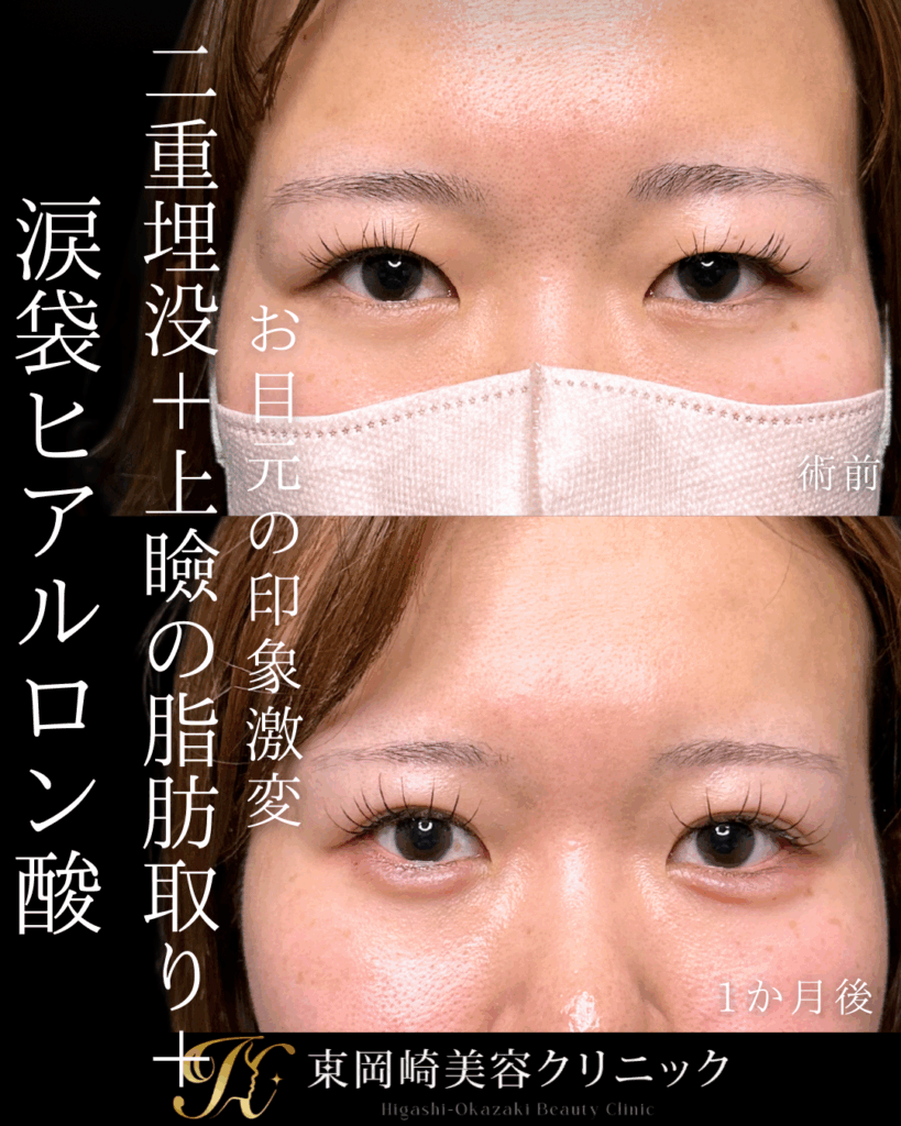症例イメージ