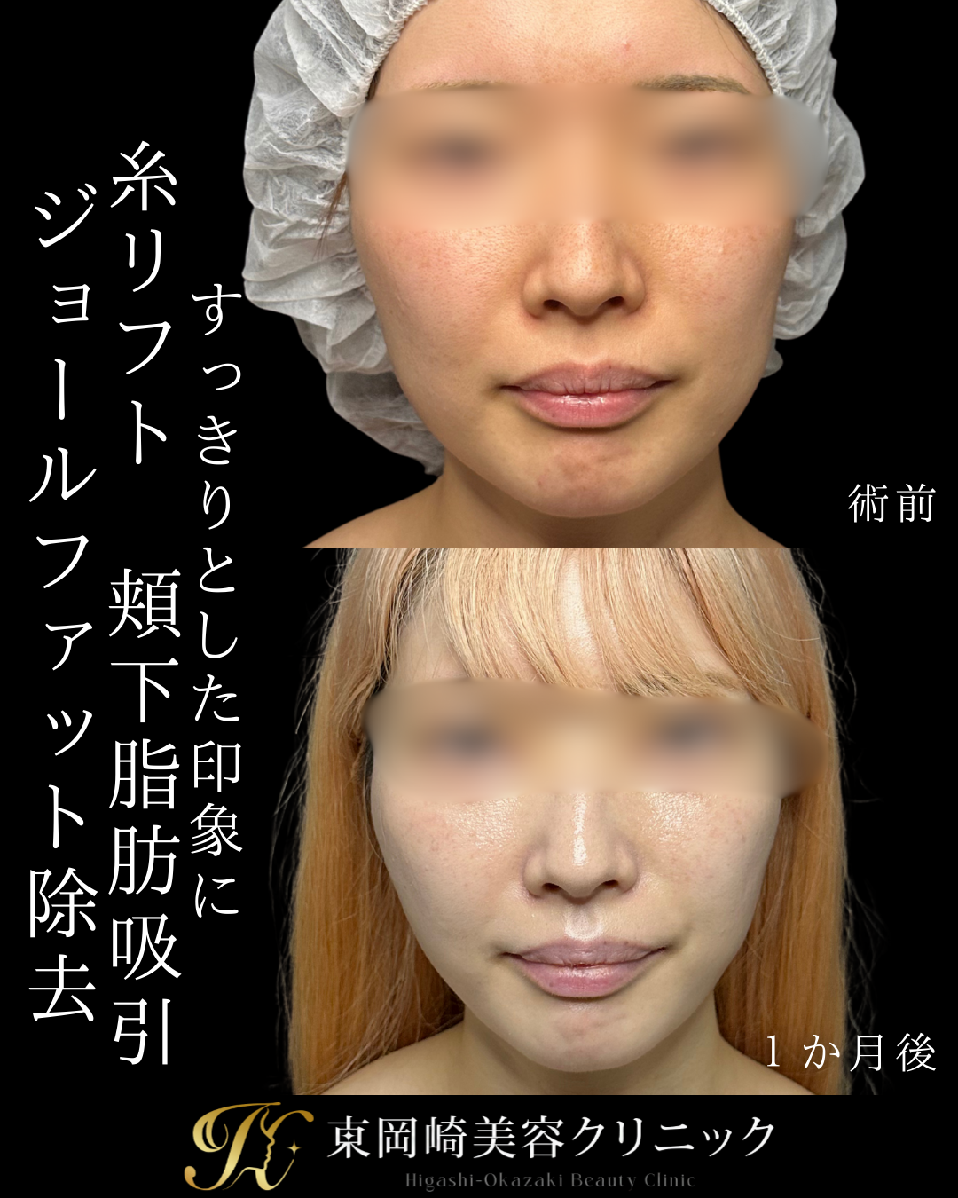 症例イメージ