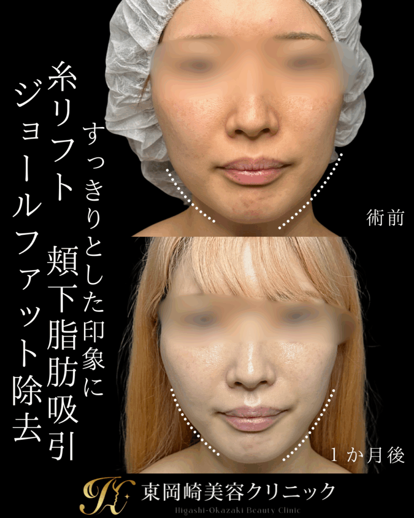 症例イメージ