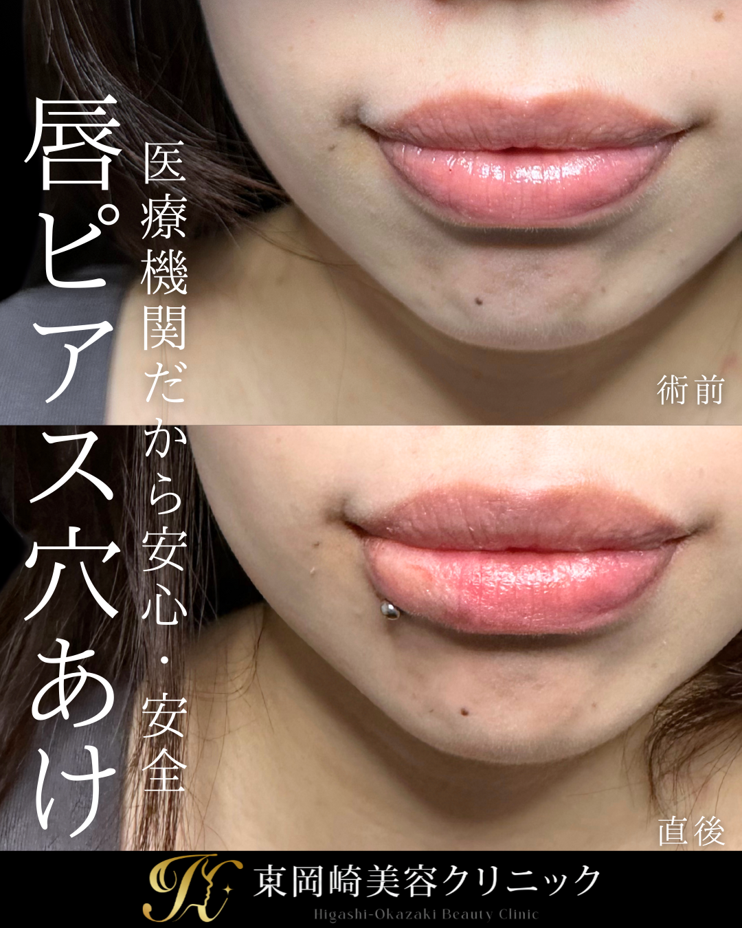 症例イメージ