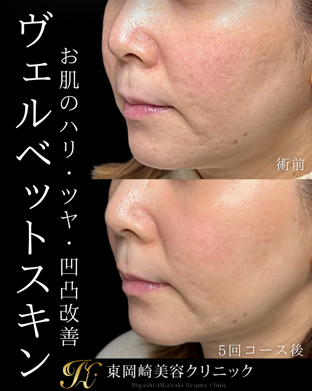 症例イメージ