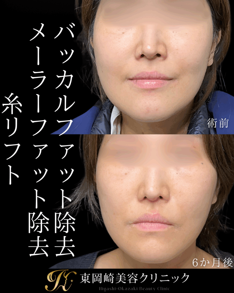 症例イメージ