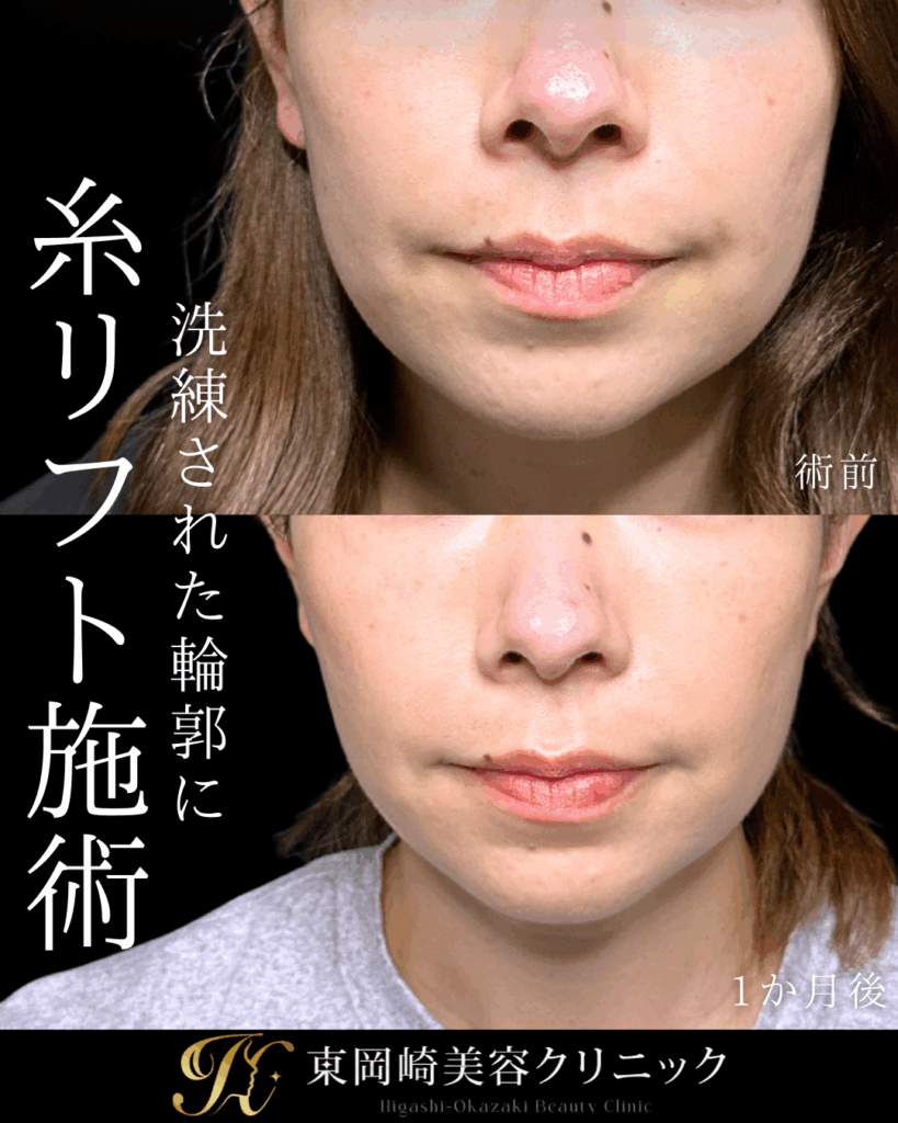 症例イメージ