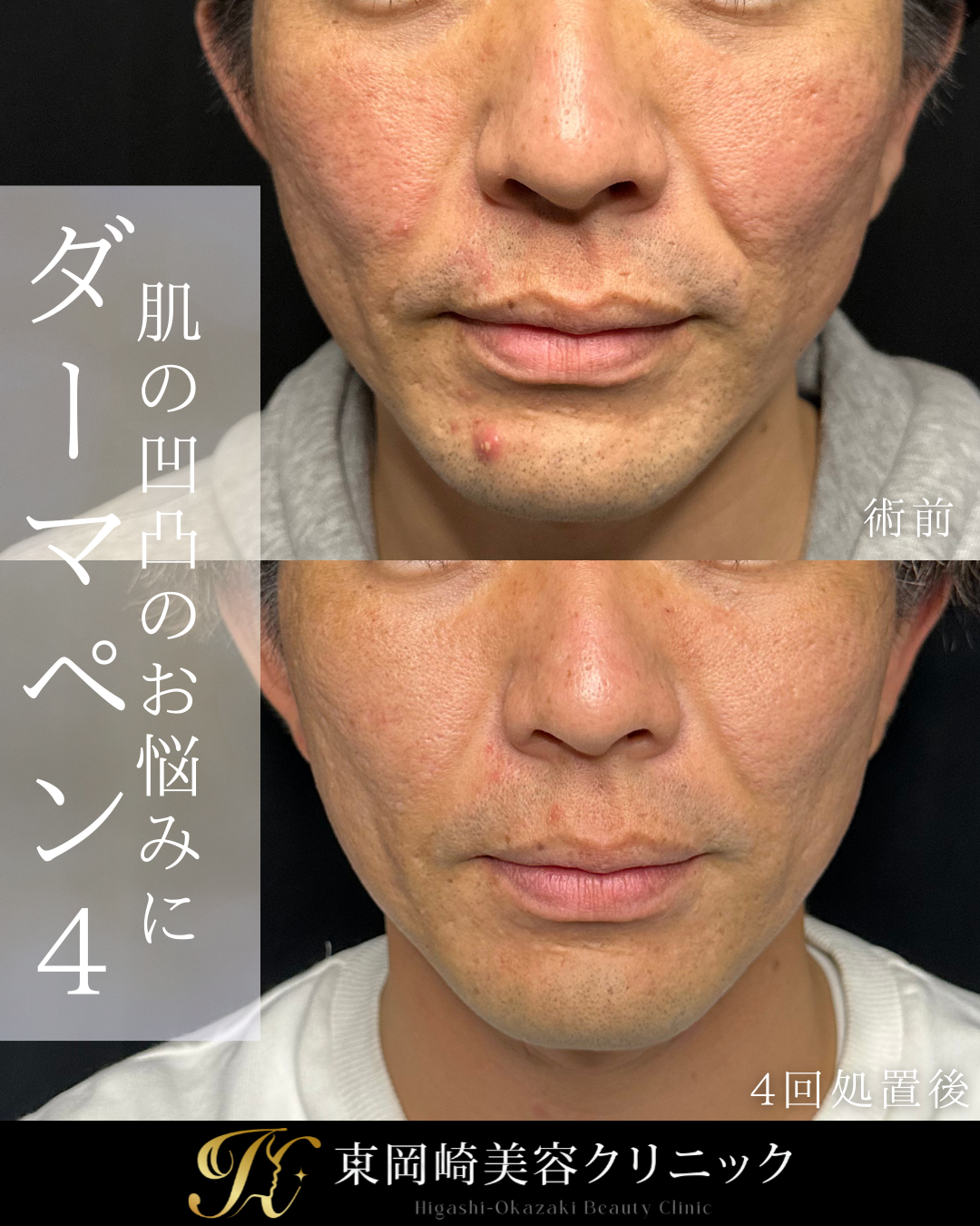 症例イメージ