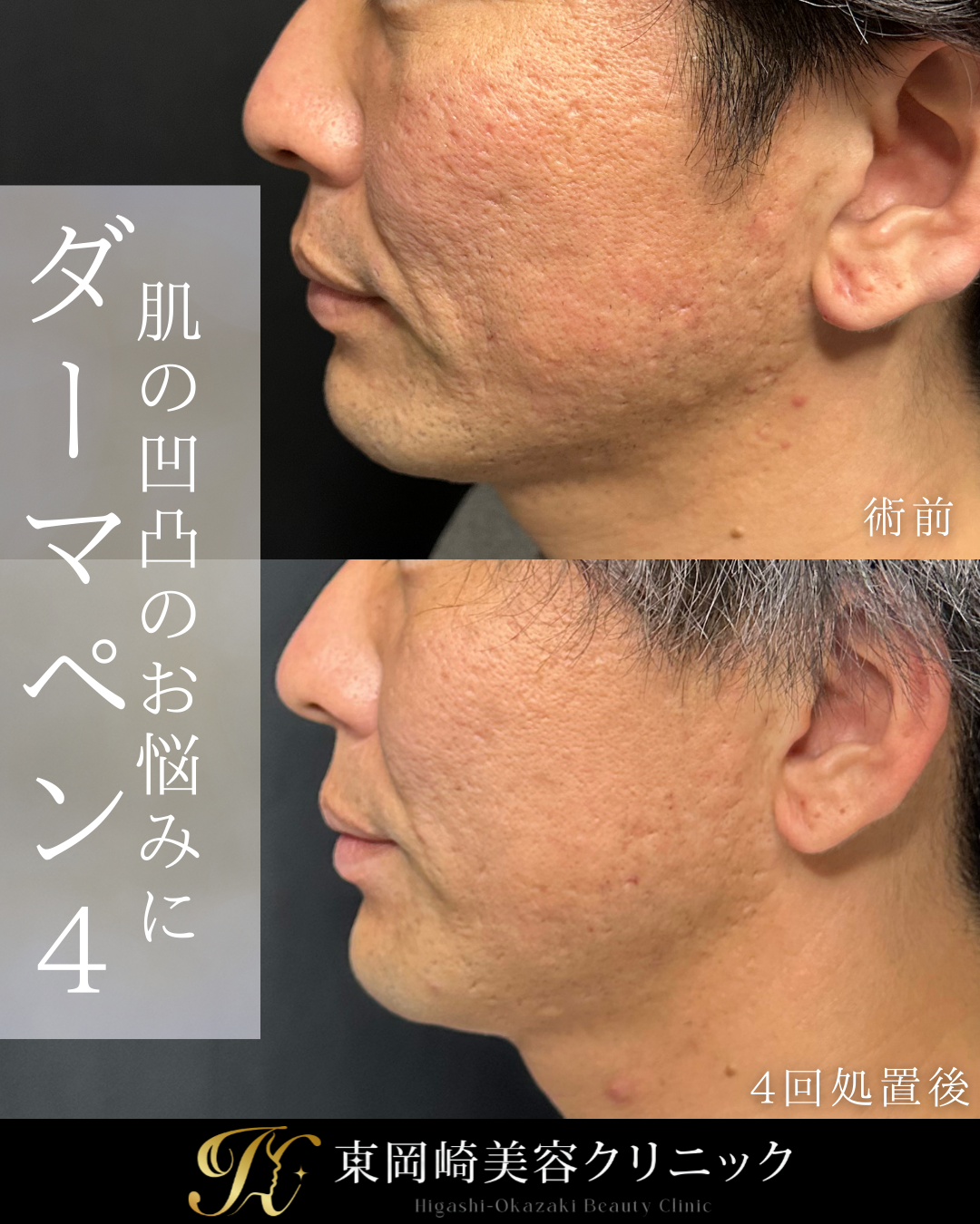 症例イメージ