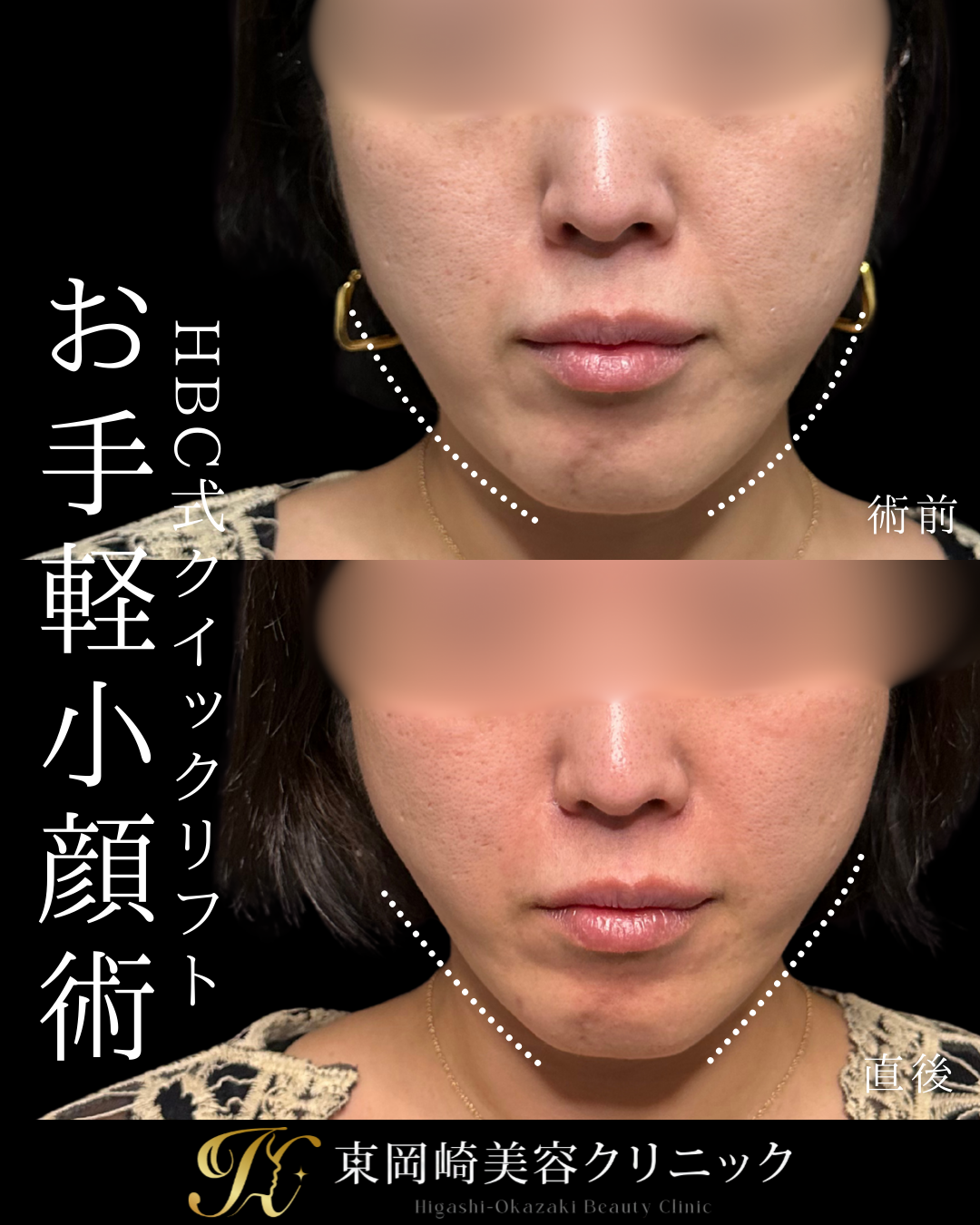 症例イメージ